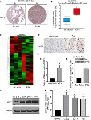 Suppression of ANT2 by miR-137 Inhibits Prostate Tumorigenesis